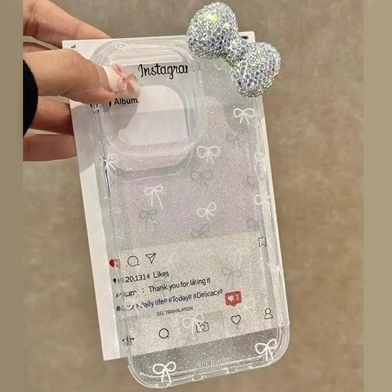 Custodia per telefono con fioc - Luxury Watch Case recensione e prezzo